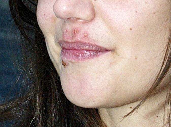 Comment embrasser sur les lèvres ? (Celebrity Exclusive)