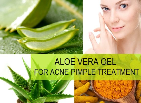 Does aloe vera clear pimples? (Celebrity Exclusive)