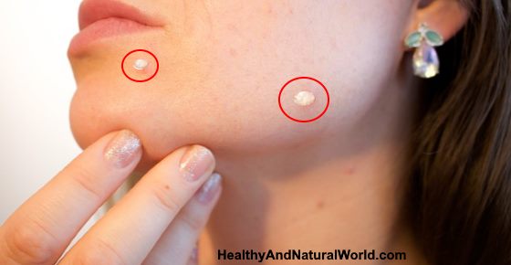 How do I get rid of calcium build up in my kettle? (Celebrity Exclusive)