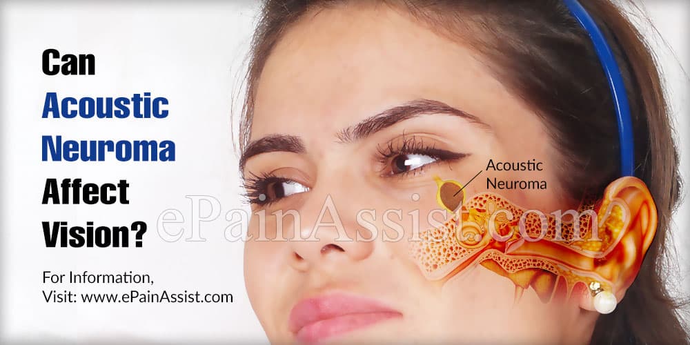 Can acoustic neuroma affect eyesight?