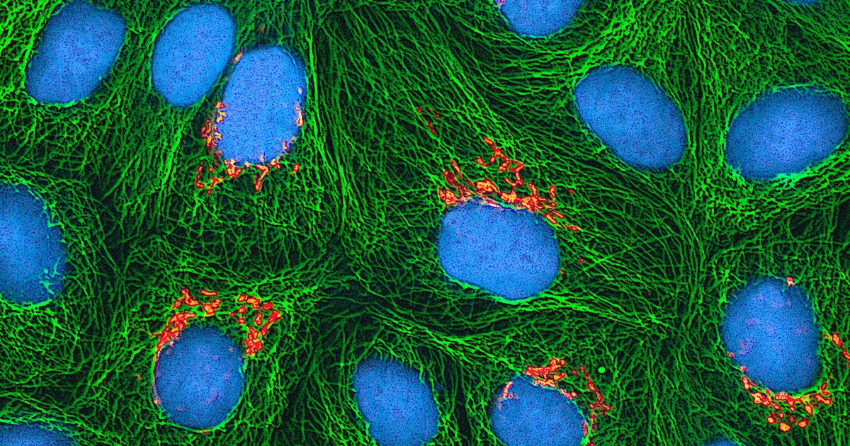 Did George Gey meet Henrietta?