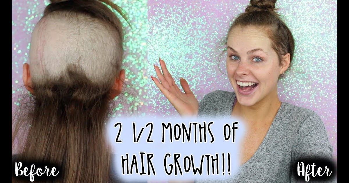 Does Hulk's hair grow?