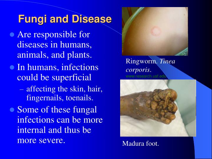 What disease does Doc Ock have?