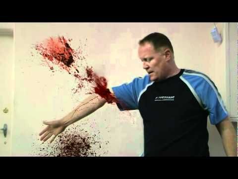 Who cut off Bucky's arm?