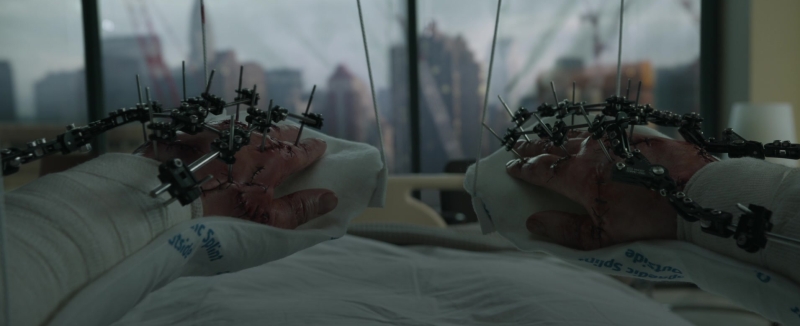 Who is the 22 year old struck by lightning Dr Strange?