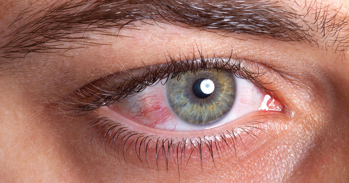 Why are Heimdall's eyes orange?