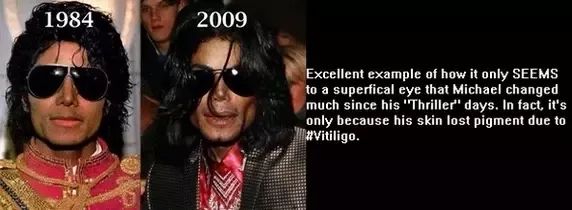 Why did Vision turn white?