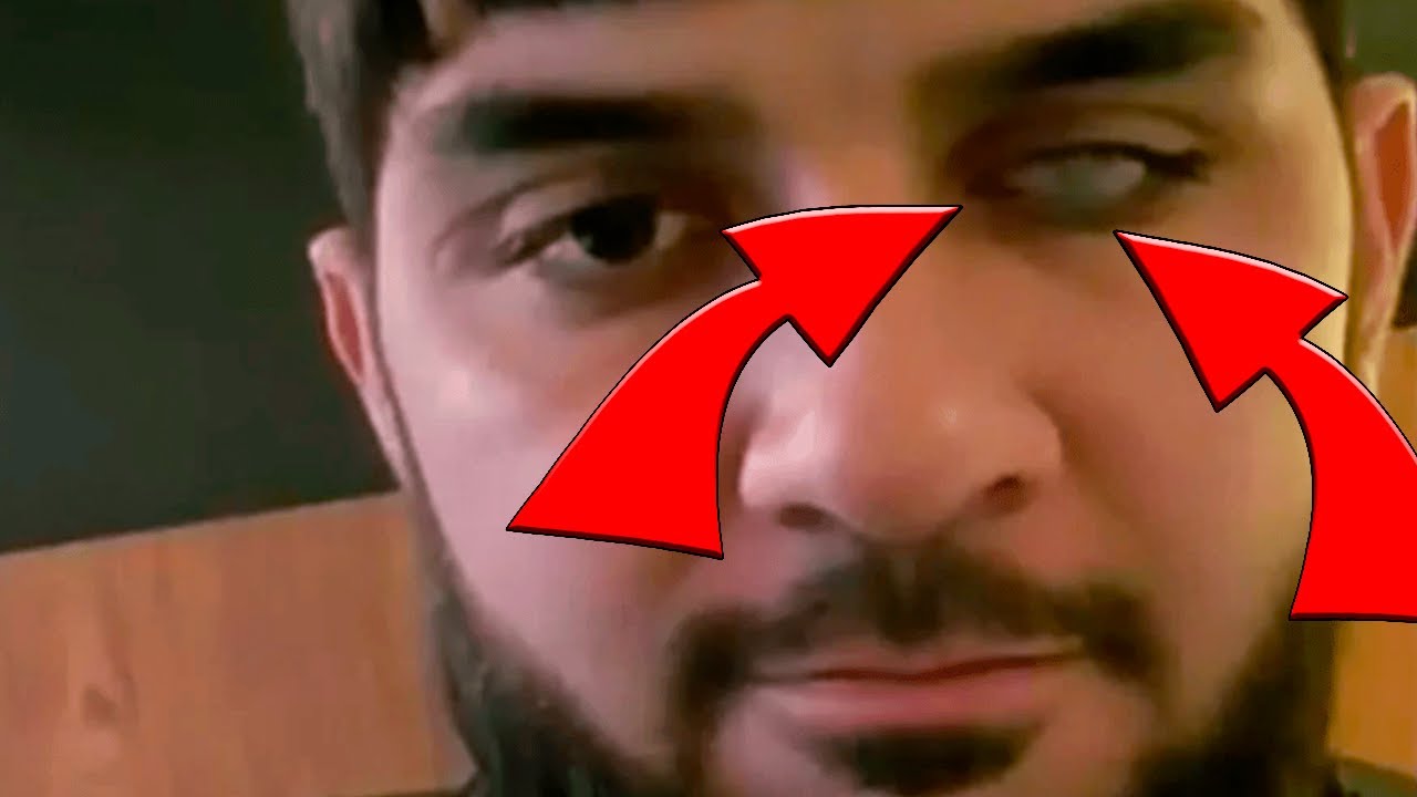 Что у Тора с глазом?